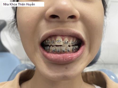 Hình ảnh Nha Khoa Thiện Huyền