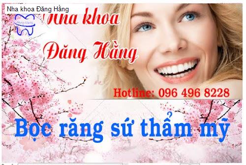 Hình ảnh Nha khoa Đăng Hằng