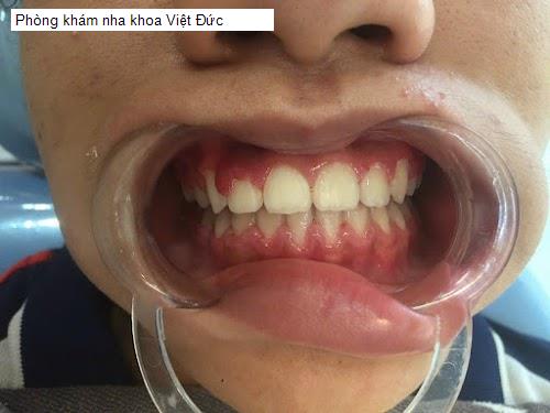 Hình ảnh Phòng khám nha khoa Việt Đức