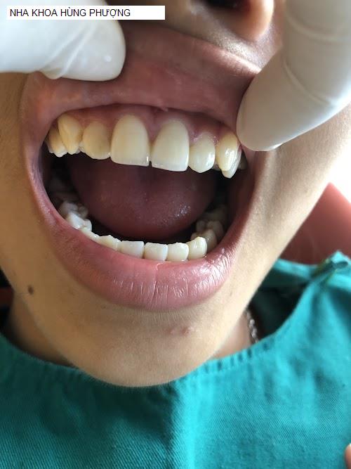 Hình ảnh NHA KHOA HÙNG PHƯỢNG